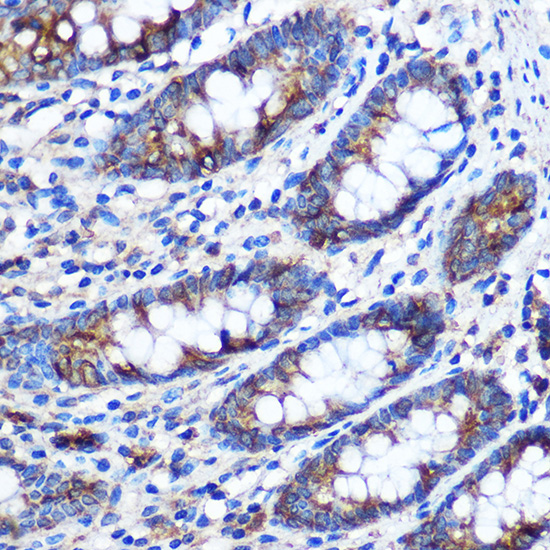 Anti-STAT4 Antibody (CAB2638)