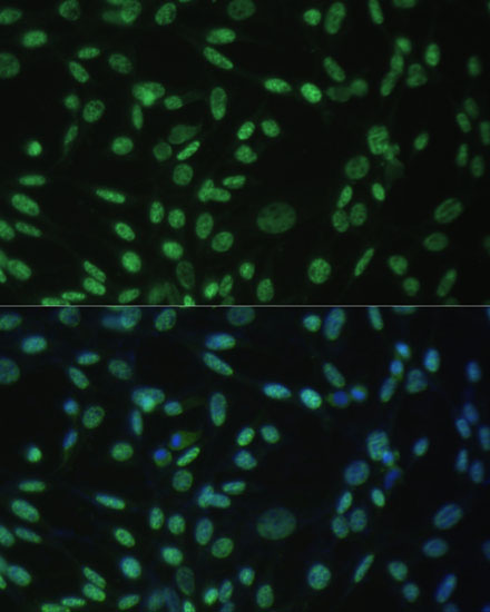 Anti-ALYREF Antibody (CAB6010)