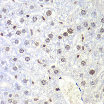 Anti-UHRF2 Antibody (CAB13602)