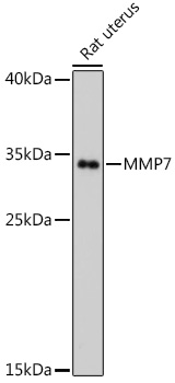 Anti-MMP7 Antibody (CAB0695)