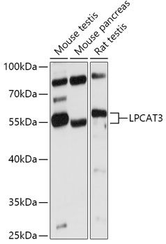 Anti-LPCAT3 Antibody (CAB17604)