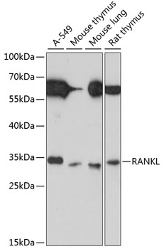 Anti-RANKL Antibody (CAB13567)