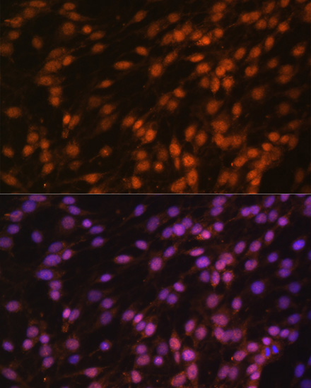 Anti-FUBP1 Antibody (CAB5587)