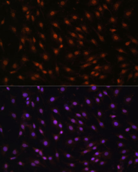 Anti-CDKN1B/p27KIP1 Antibody (CAB16722)