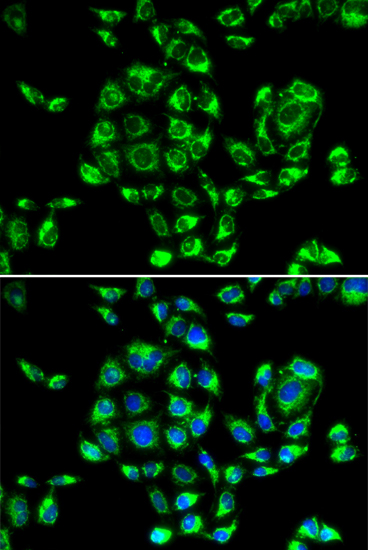 Anti-RPS16 Antibody (CAB6976)