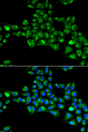 Anti-CYGB Antibody (CAB14155)