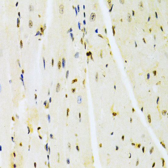 Anti-HMGB1 Antibody [KO Validated] (CAB2553)