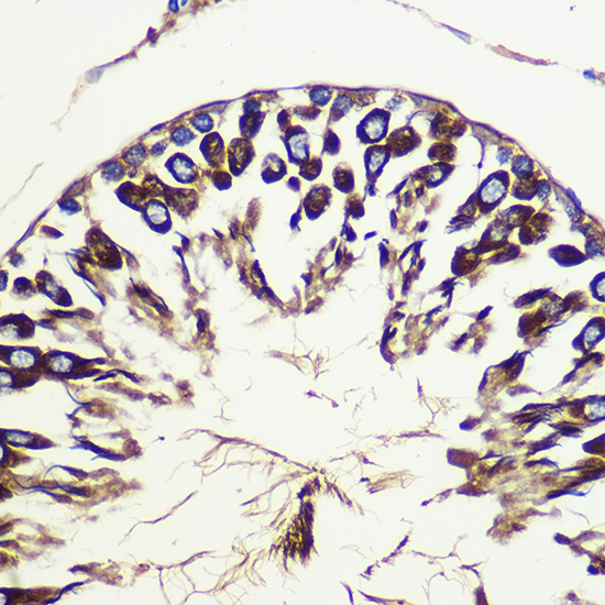 Anti-ATG10 Antibody (CAB7390)