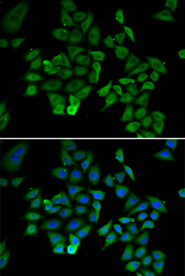 Anti-NFKBIB Antibody (CAB5777)