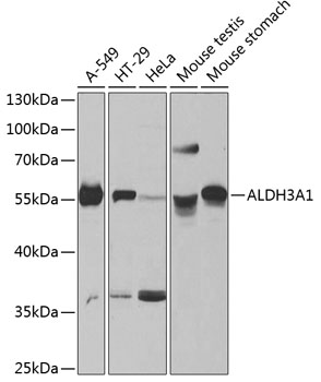 Anti-ALDH3A1 Antibody (CAB13275)