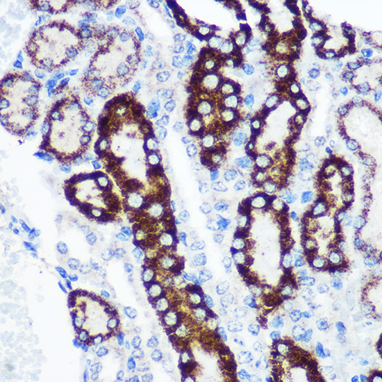 Anti-FCHSD1 Antibody (CAB15543)