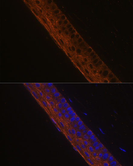 Anti-MYH13 Antibody (CAB14620)