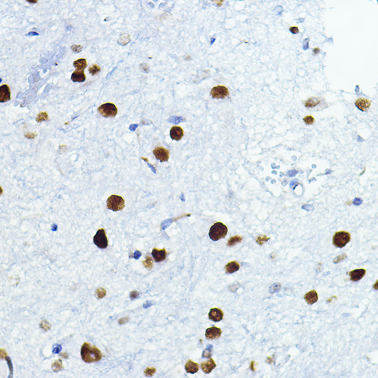 Anti-FOSL1 Antibody (CAB5372)