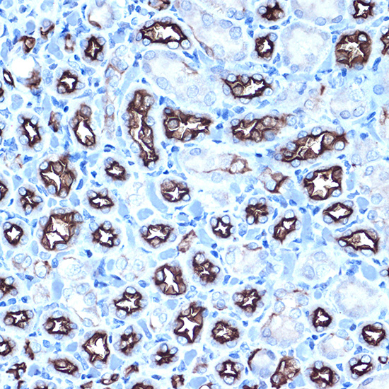 Anti-MUC1 Antibody (CAB0333)