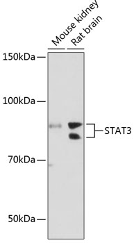 Anti-STAT3 Antibody [KO Validated] (CAB19566)