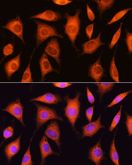 Anti-EXOSC2 Antibody (CAB10450)