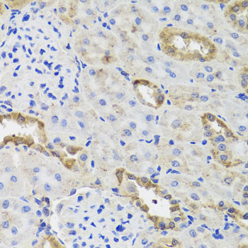 Anti-Hexokinase-3 Polyclonal Antibody (CAB8428)