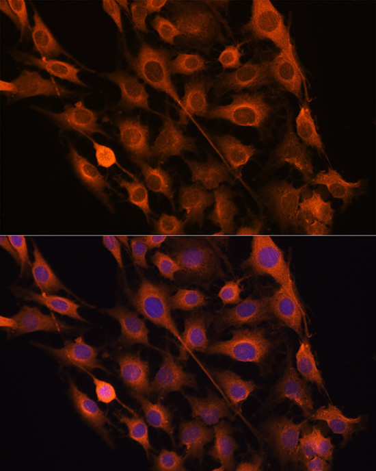 Anti-RNH1 Antibody (CAB4079)