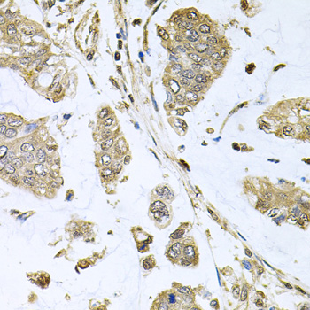 Anti-SBDS Antibody (CAB5876)