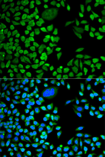 Anti-TIA1 Antibody (CAB6237)