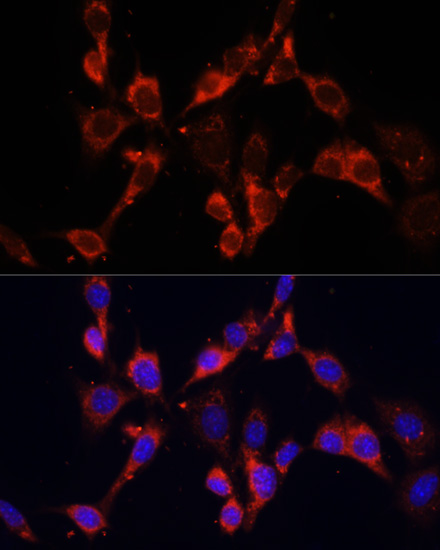 Anti-DVL2 Antibody (CAB7551)