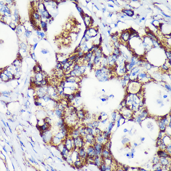 Anti-TACO1 Antibody (CAB15445)