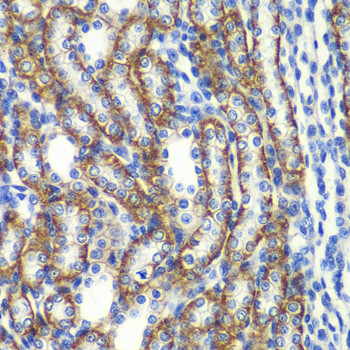 Anti-ZFAND3 Antibody (CAB7478)