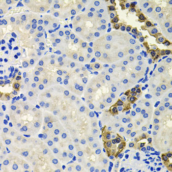 Anti-Calretinin Polyclonal Antibody (CAB9807)