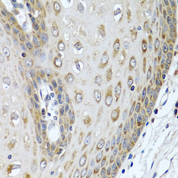 Anti-LRG1 Antibody (CAB7850)