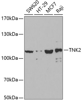 Anti-TNK2 Antibody (CAB2526)