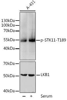 Anti-Phospho-STK11-T189 Antibody (CABP0603)