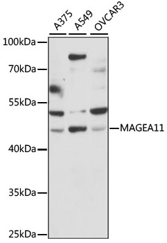 Anti-MAGEA11 Antibody (CAB15288)