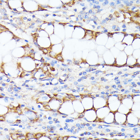 Anti-SMYD4 Antibody (CAB7310)