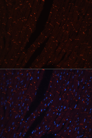 Anti-N-Cadherin Antibody [KO Validated] (CAB0432)