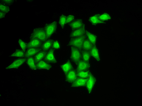 Anti-SSRP1 Antibody (CAB13636)