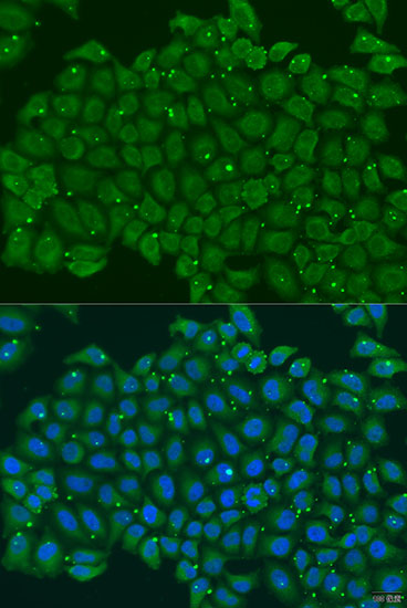 Anti-TNNC2 Antibody (CAB7740)