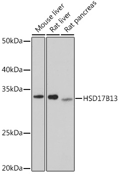 Anti-HSD17B13 Antibody (CAB6256)