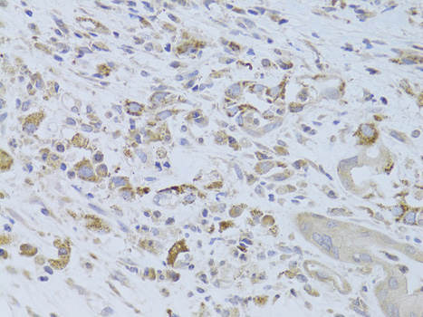 Anti-IGF2 Antibody (CAB14005)