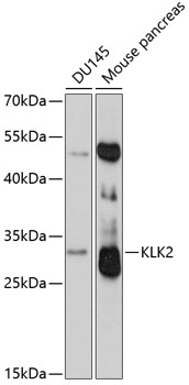 Anti-KLK2 Antibody (CAB2990)