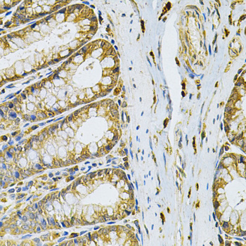 Anti-RRAGC Antibody (CAB7479)