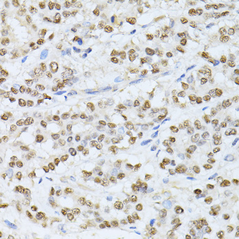 Anti-SATB1 Antibody (CAB5800)