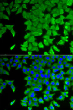 Anti-CRABP2 Antibody (CAB6119)