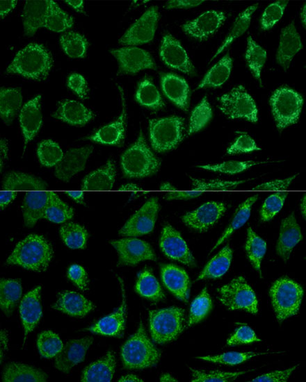 Anti-Bcl-2 Antibody (CAB11025)