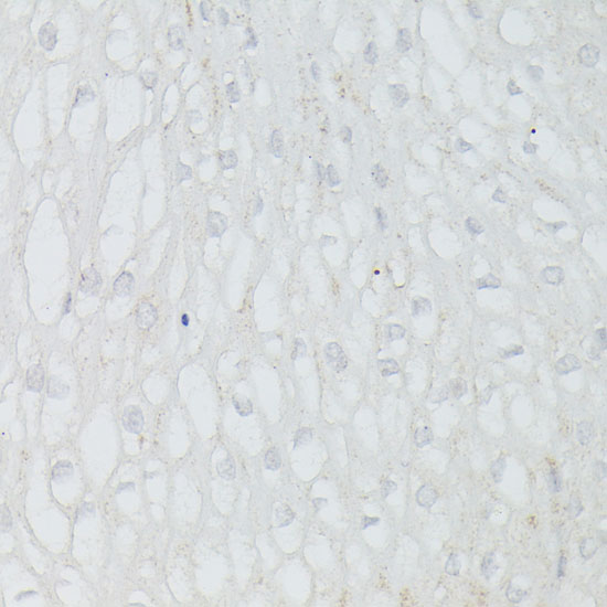 Anti-p53 Antibody [KO Validated] (CAB11232)