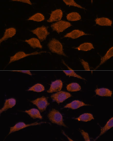 Anti-USP19 Polyclonal Antibody (CAB9723)