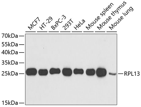 Anti-RPL13 Antibody (CAB6723)