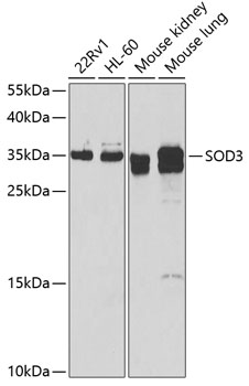 Anti-SOD3 Antibody (CAB6984)