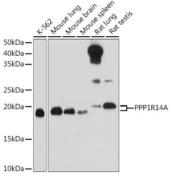 Anti-PPP1R14A Antibody (CAB10160)