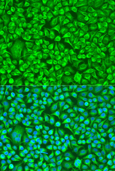 Anti-TUBB8 Polyclonal Antibody (CAB8396)