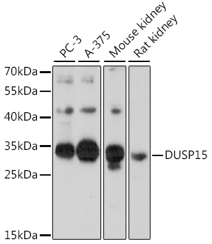 Anti-DUSP15 Antibody (CAB16322)